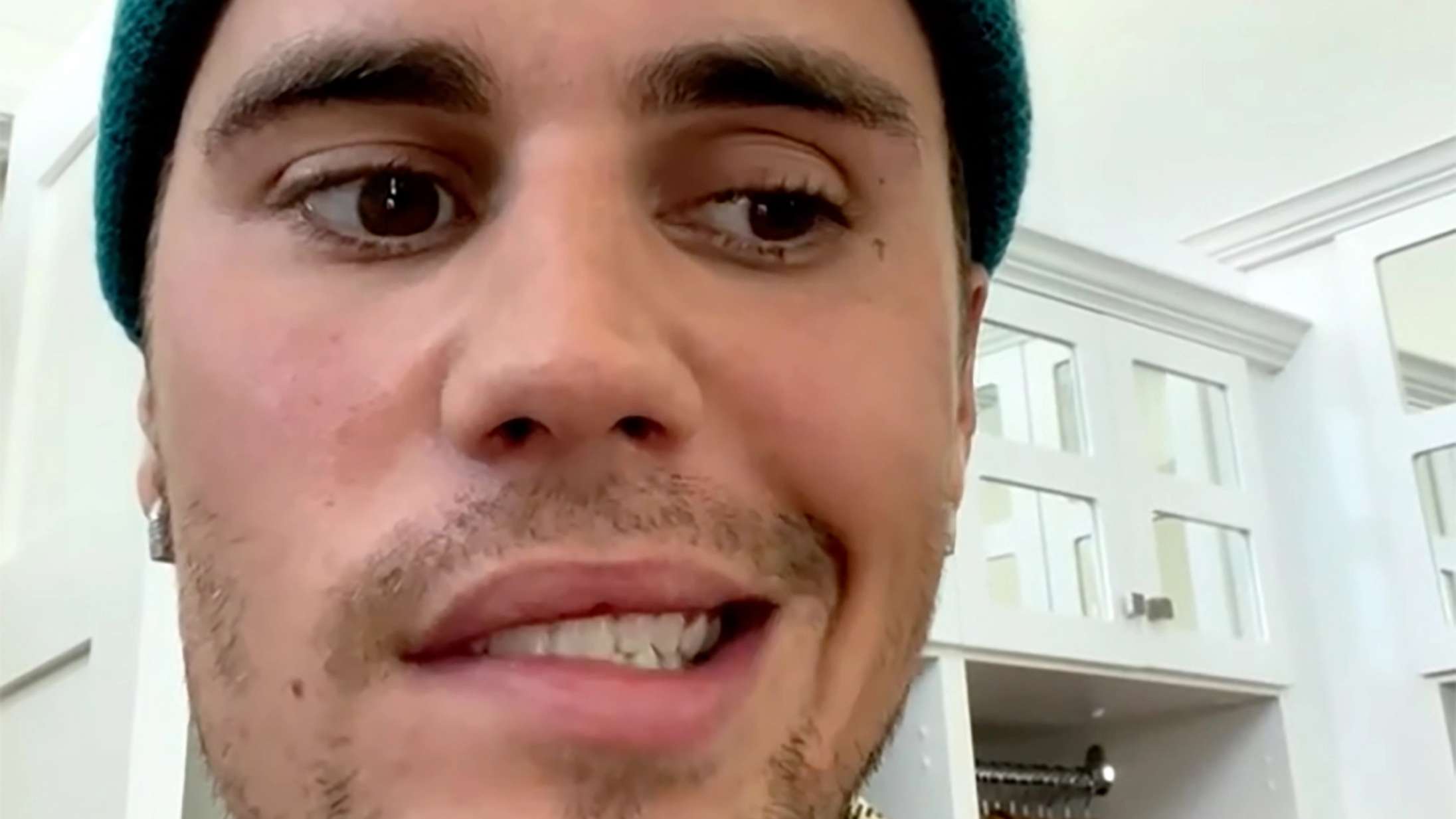 Efter ansigtslammelse: Nu kan Justin Bieber smile igen – se videoen