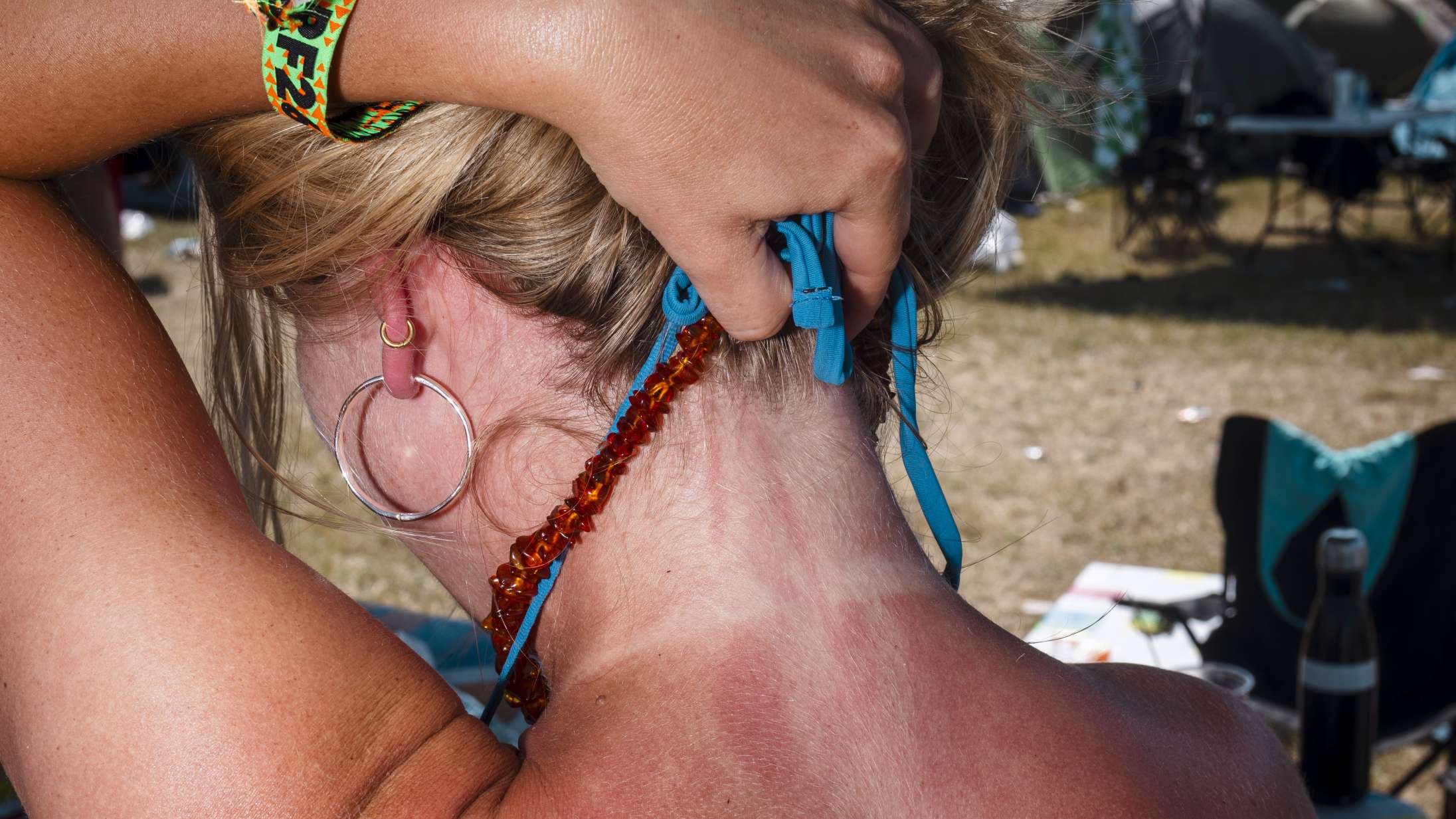 Rød, rødere, rødest: Se Roskilde Festivals mest vanvittige tanlines